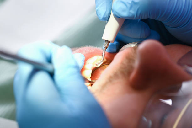 Best Emergency Root Canal Therapy in Albany, KY